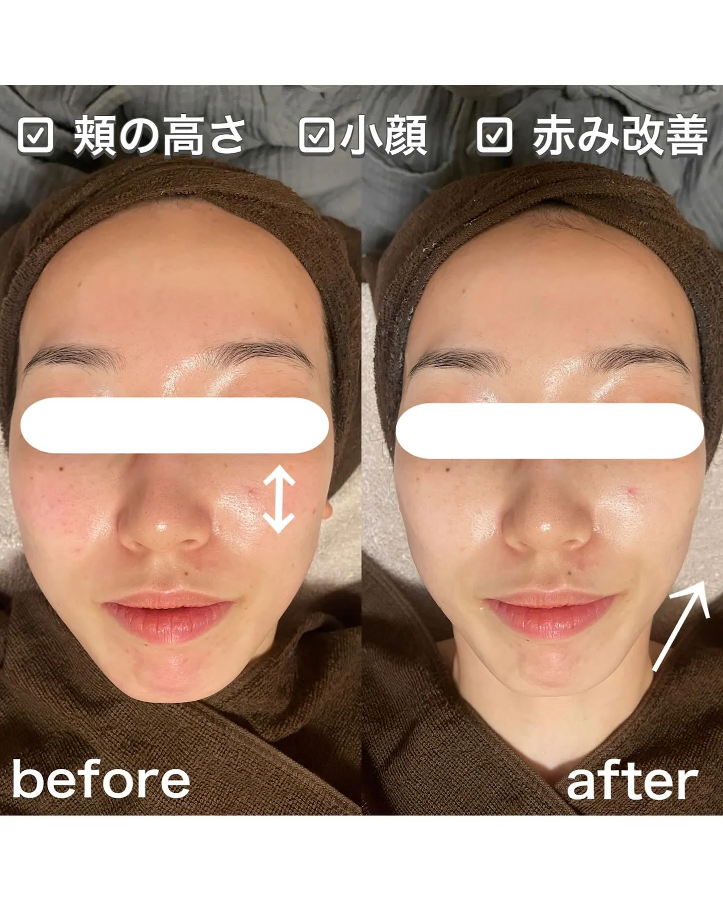 プライベートサロンの小顔エステ💆♀️💐