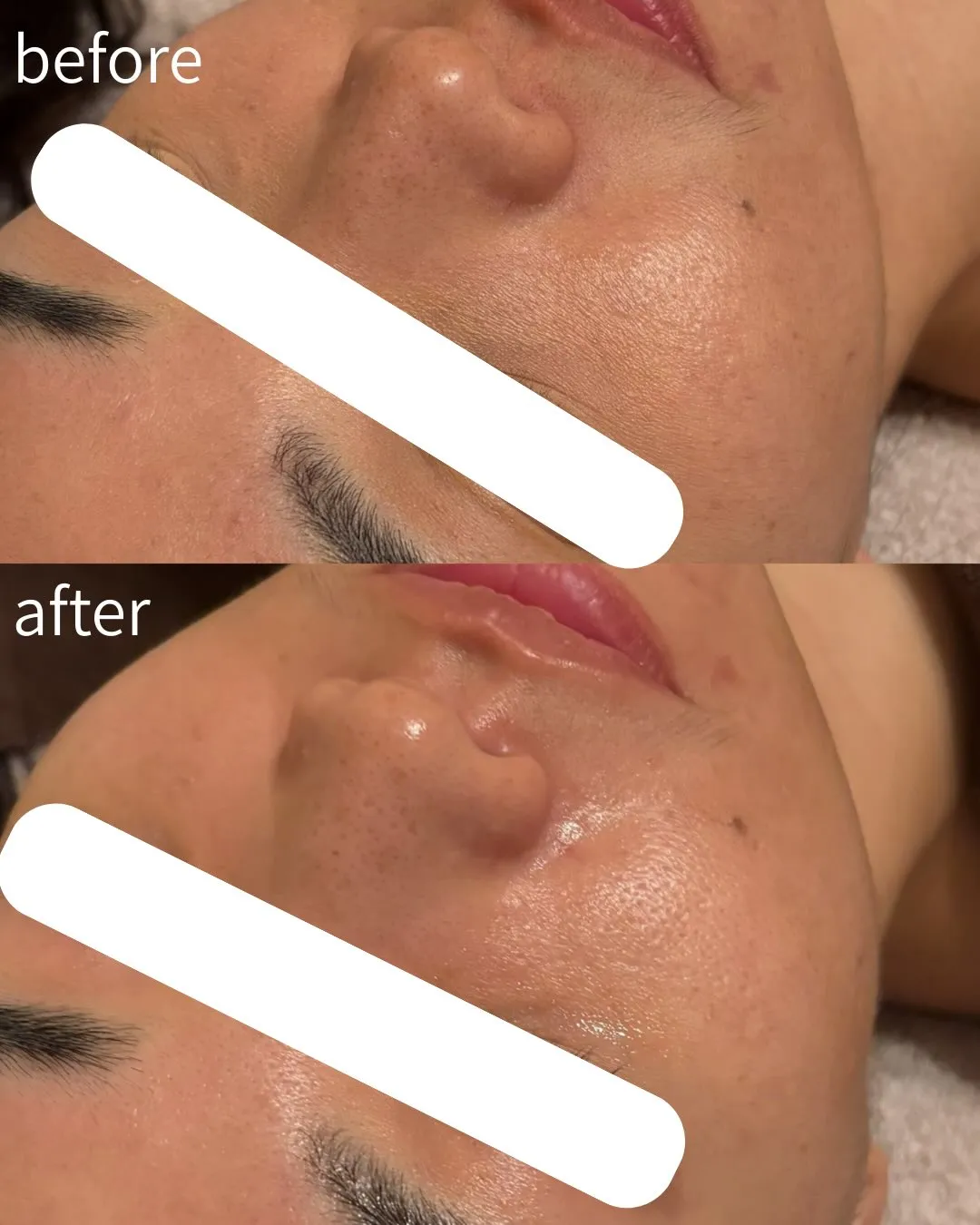 30代/乾燥/小ジワ/くすみ...