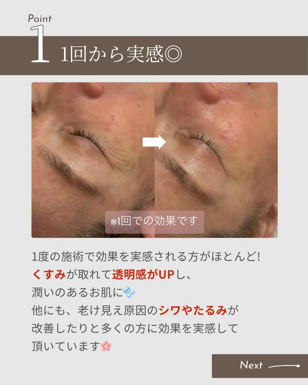 台東区/浅草橋のフェイシャルサロンで若見えケア💆‍♀️✨