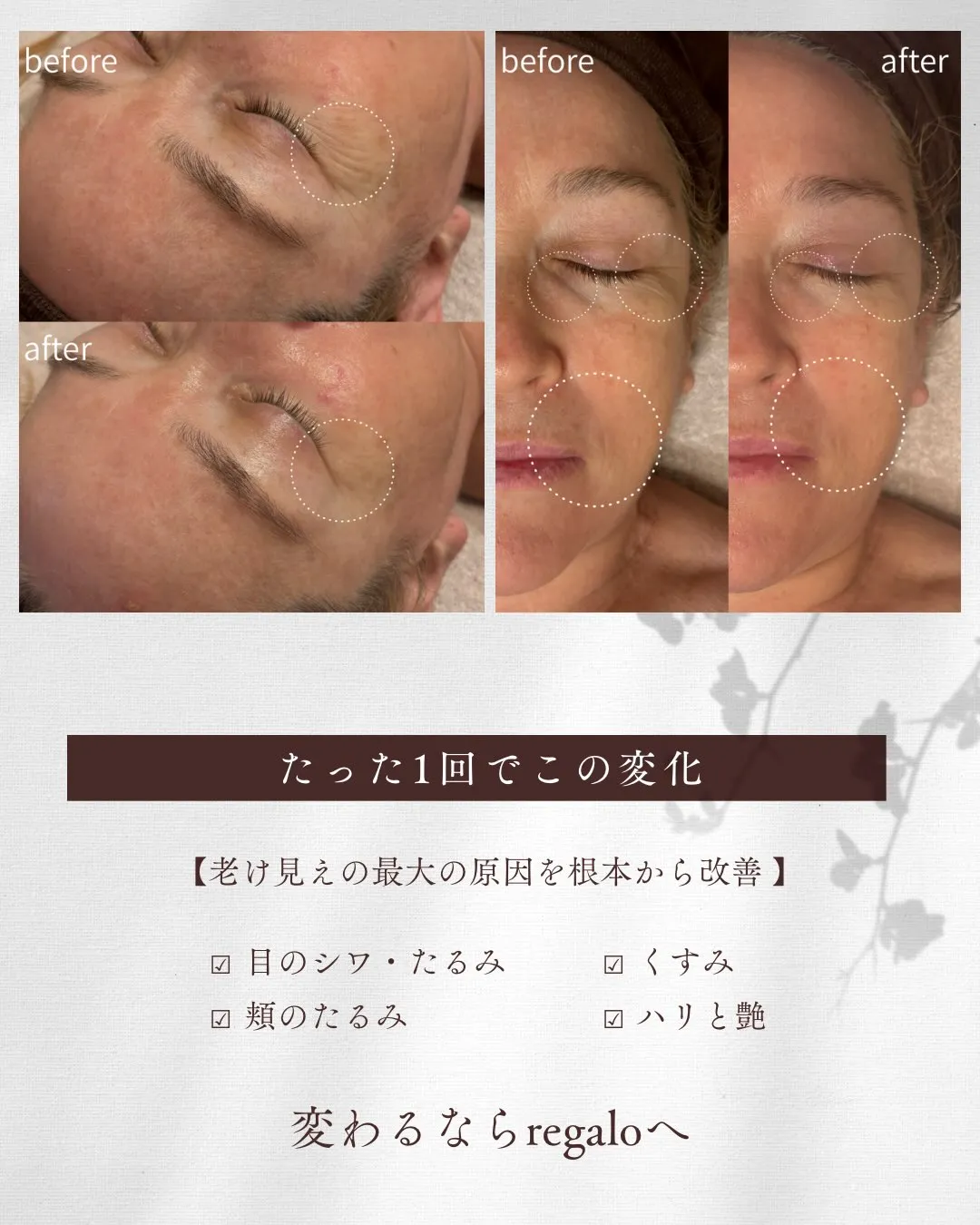 福岡/香椎　若見えサロン regalo