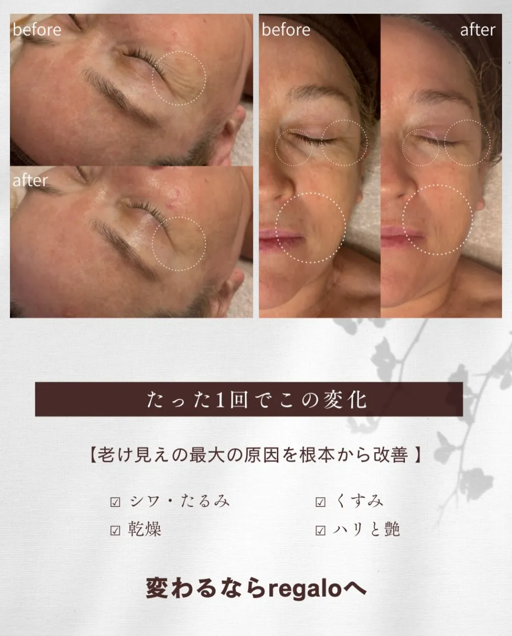 一度の施術でも変化を実感できる、40代からの若見えフェイシャ...